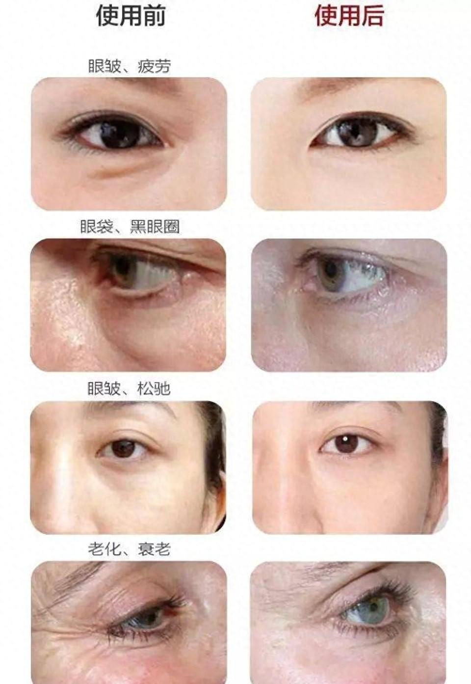 手机成瘾:睡前玩手机竟导致5大“毛病”